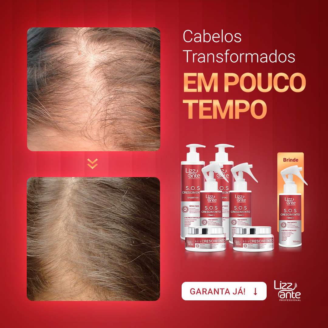 Queda de cabelo após Covid