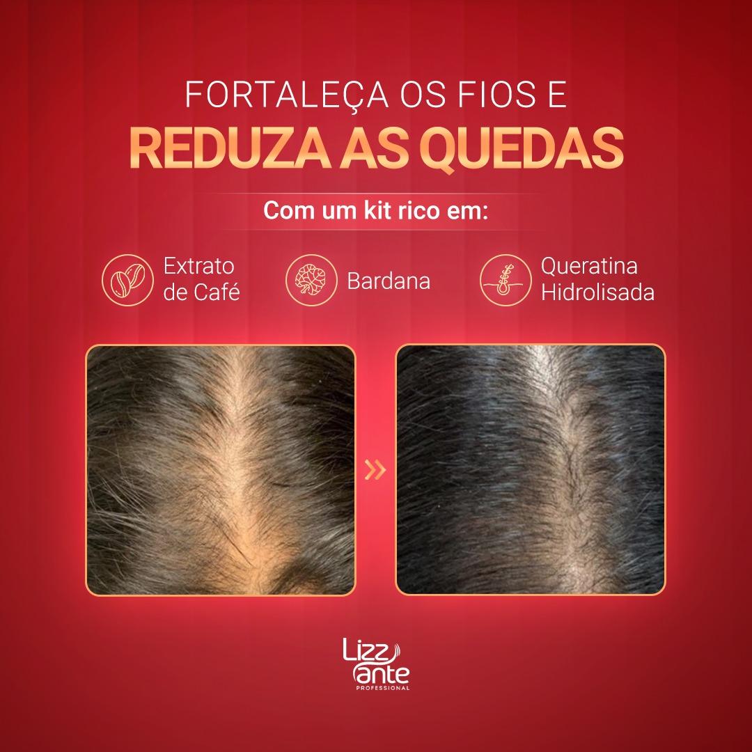 Queda de cabelo após Covid