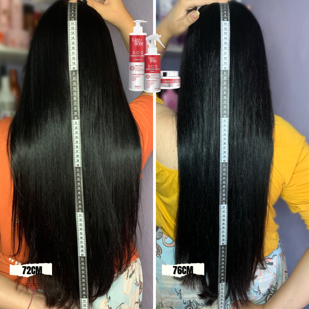 Queda de cabelo após Covid