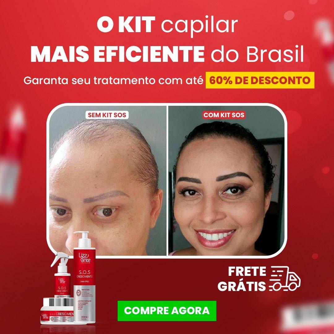 Queda de cabelo após Covid